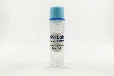 Alveolar Epithelial Type I Cells