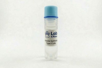 Alveolar Epithelial Type II Cells