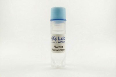 Alveolar Macrophages