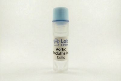 Aortic Endothelial Cells