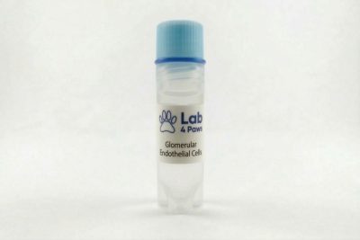 Glomerular Endothelial Cells