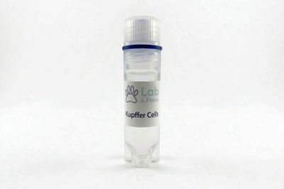 Kupffer cells