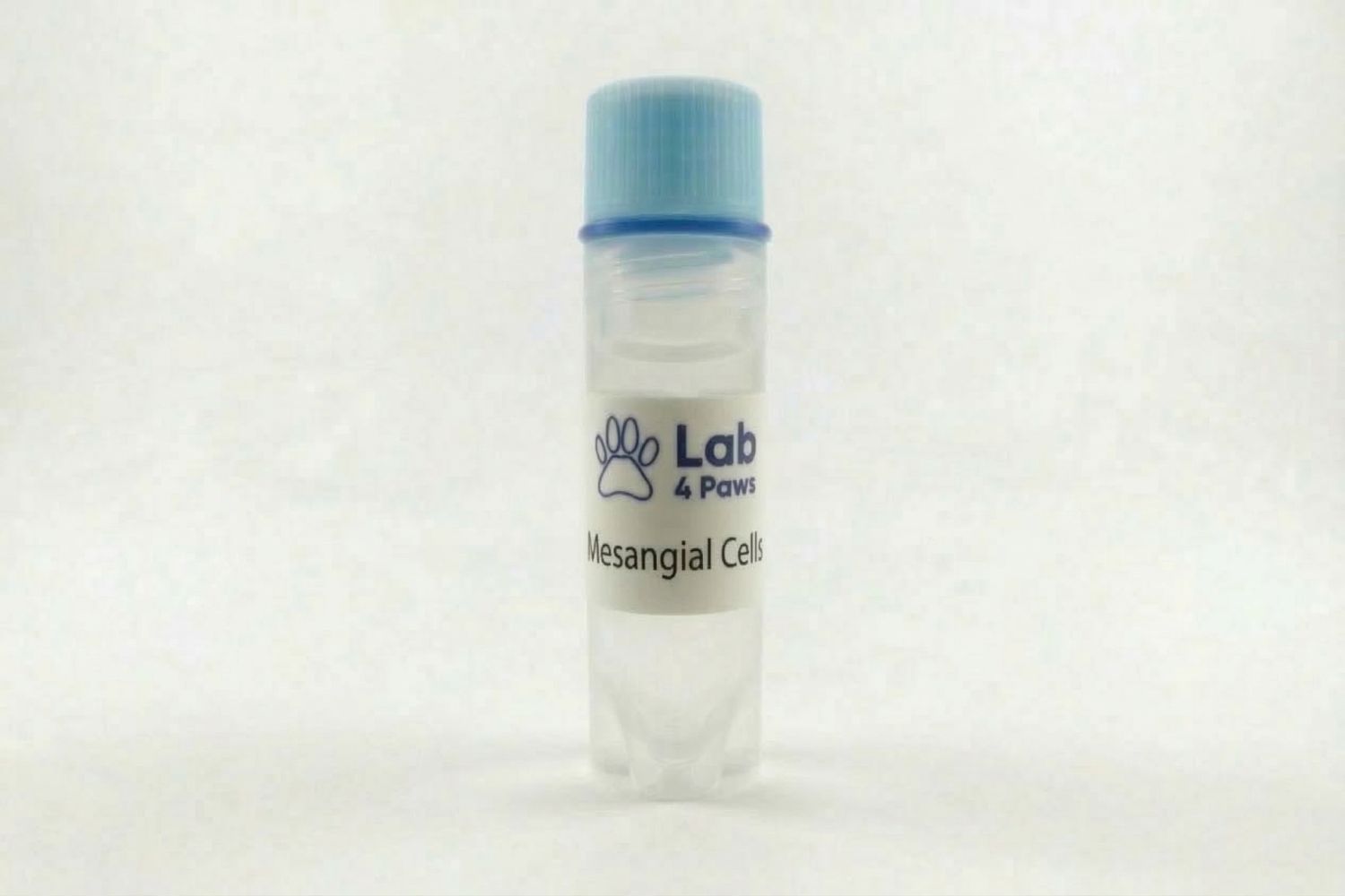 Mesangial Cells