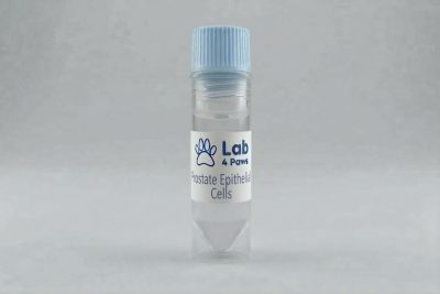 Prostate Epithelial Cells