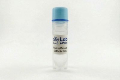 Proximal Tubular Epithelial Cells