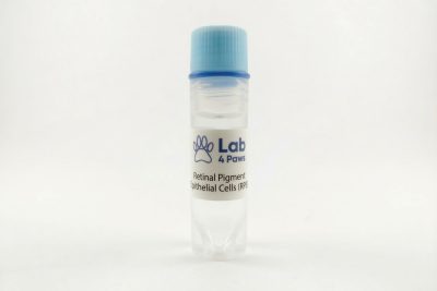 Retinal Pigment Epithelial Cells (RPE)